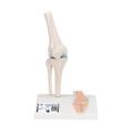 3B Scientific Mini Knee Joint with cross section - w/ 3B Smart Anatomy 1000170